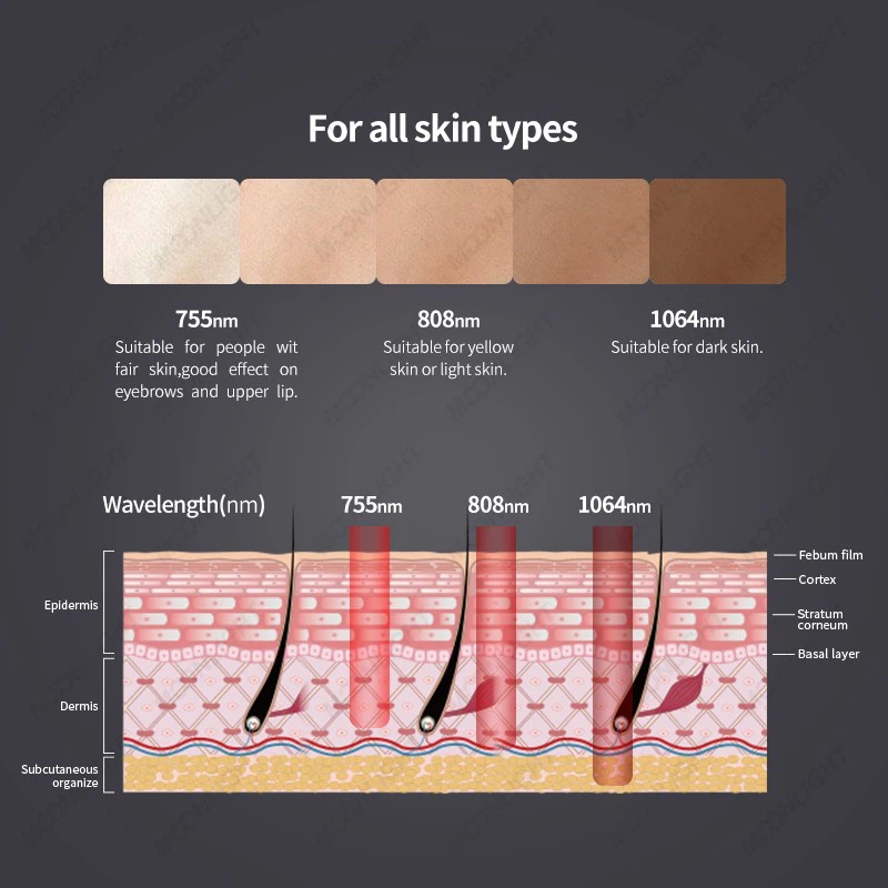 Beauty Machine Laser Hair Removal price