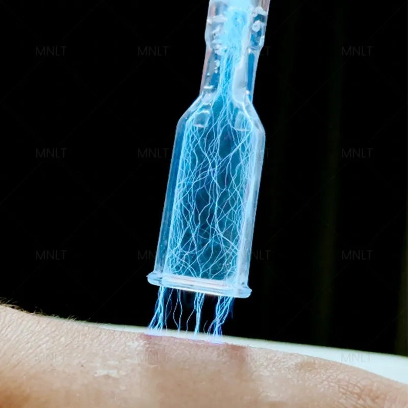 Fractional Cold Plasma best